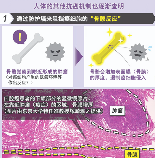 日本研究者等探究人体内抗癌“武器”