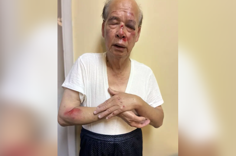 93岁知名侨领 超市外遭劫匪残忍拖行